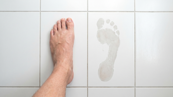 How Do I Know If I Need Arch Support? 5 Signs Your Feet Are Telling You