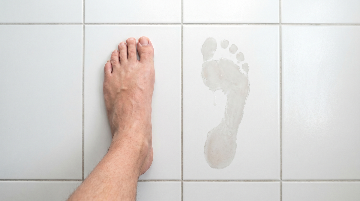 How Do I Know If I Need Arch Support? 5 Signs Your Feet Are Telling You